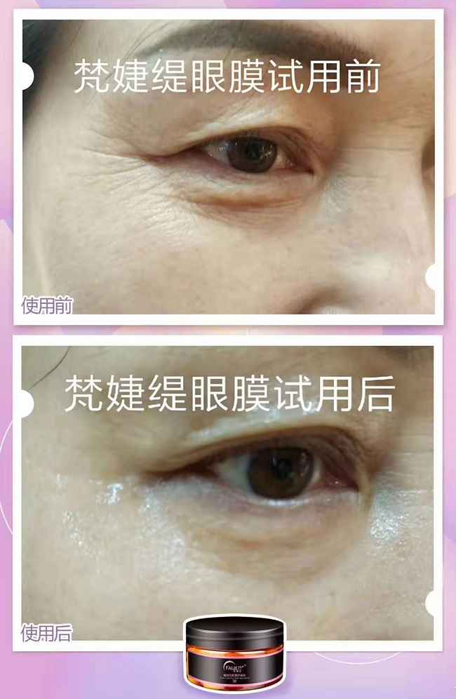 这篇文章告诉你,梵婕缇眼膜好用吗? 这篇文章告诉你,梵婕缇眼膜好用吗?