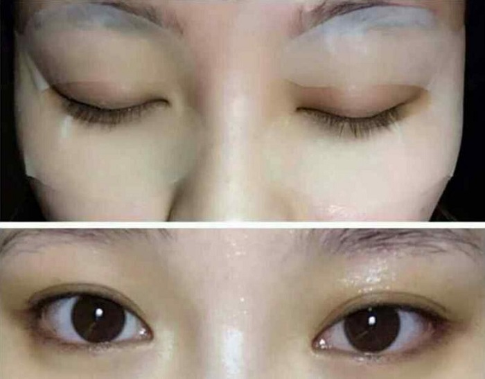 黑眼圈怎么办,可以使用媚眼明眸果纤眼贴吗 黑眼圈怎么办,可以使用媚眼明眸果纤眼贴吗