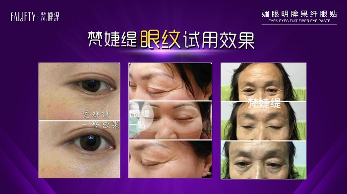 25岁的女人适合用什么牌子的眼膜好 25岁的女人适合用什么牌子的眼膜好