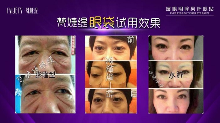 25岁的女人适合用什么牌子的眼膜好 25岁的女人适合用什么牌子的眼膜好