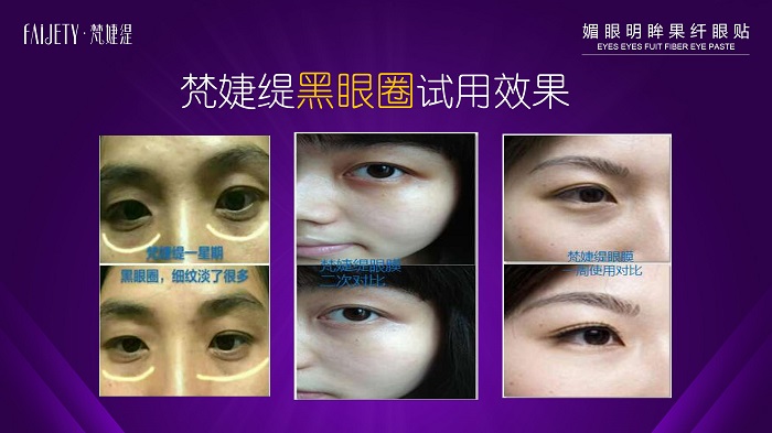 25岁的女人适合用什么牌子的眼膜好 25岁的女人适合用什么牌子的眼膜好