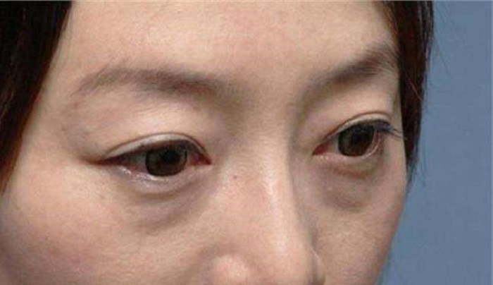 25岁的女人适合用什么牌子的眼膜好 25岁的女人适合用什么牌子的眼膜好